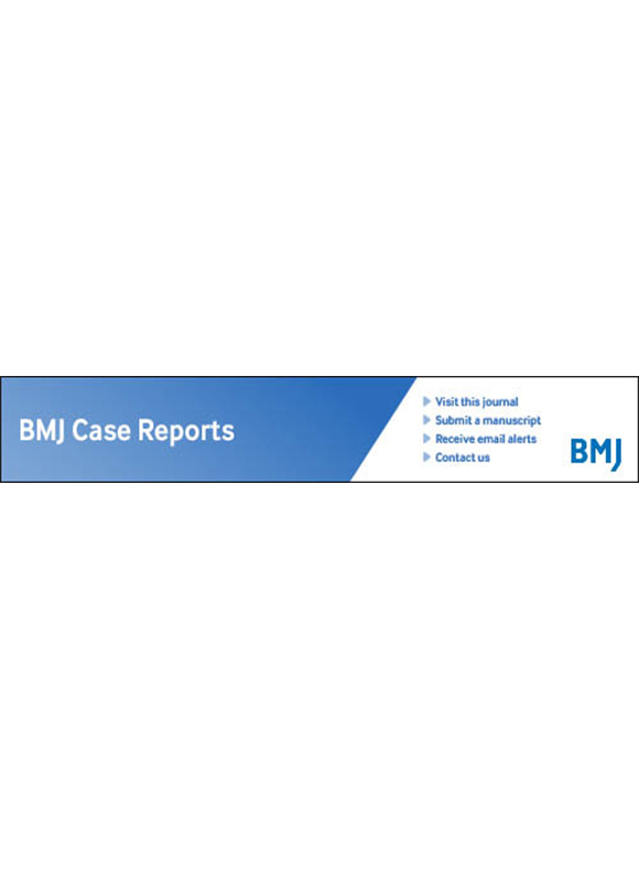 Bmj 病例报告杂志-Bmj Case Reports-首页